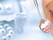 Лазерное отбеливание зубов в Москве