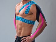 Как правильно наложить кинезио тейпы