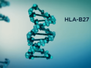 Генетический анализ HLA-B27 для чего сдают и что выявляет?