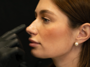 Септопластика: показания и преимущества процедуры