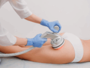 Как улучшить тонус кожи и избавиться от «апельсиновой корки»