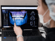 Лечение зубов в современном мире: шаг в будущее здоровой улыбки