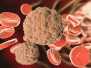 Удаление сосудистых звёздочек лазером: показания, противопоказания и результаты