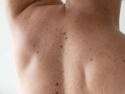 Вывих плеча: признаки, что делать и первая помощь