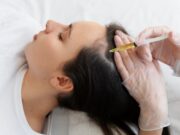 Мезотерапия кожи головы: что это и какие преимущества